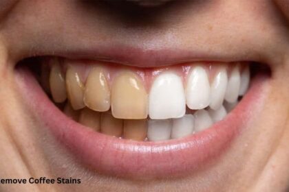 How to Remove Coffee Stains from Teeth