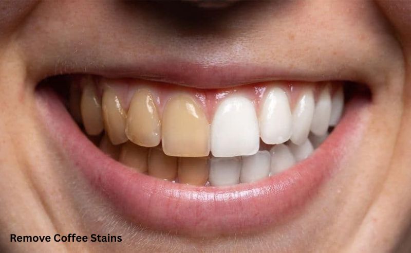 How to Remove Coffee Stains from Teeth
